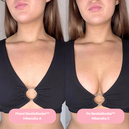 BestieBra™ – Samoprzylepne wkładki push-up